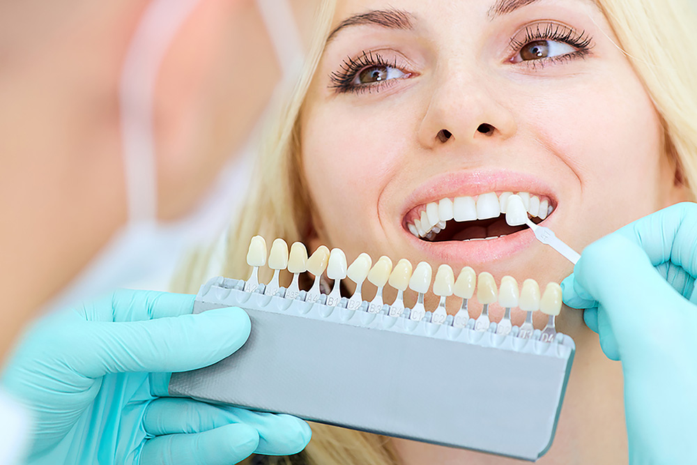 Dental Veneers in Woodbridge